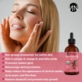 thumbnail image 2 of Kisskin ZitZap Parches para espinillas/acné para rostro y piel Parches hidrocoloides con ácido salicílico y aceite de árbol de té para cubrir granos e imperfecciones., 2 of 5