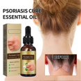 thumbnail image 2 of Psoriasis Dandruff Treatment for Scalp, Anti Itching Follicle Booster Stimulator Smoothing Nourishing Hair Serum, 2 of 5