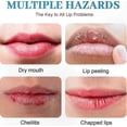 thumbnail image 5 of Vitamin E Infused Lip Balm for Dry, Cracked Lips, Natural Soothing Care for Chapped Lips Relief, 5 of 5