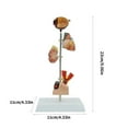 thumbnail image 5 of Milue Pathological Kidney Anatomy Model Shows Symptoms of Diabetes, 5 of 15