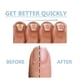 thumbnail image 5 of 1-3x 15ml Strengthen Nail Guard Nail Growth Repair Serum for Thin Nails and Growth, 5 of 5