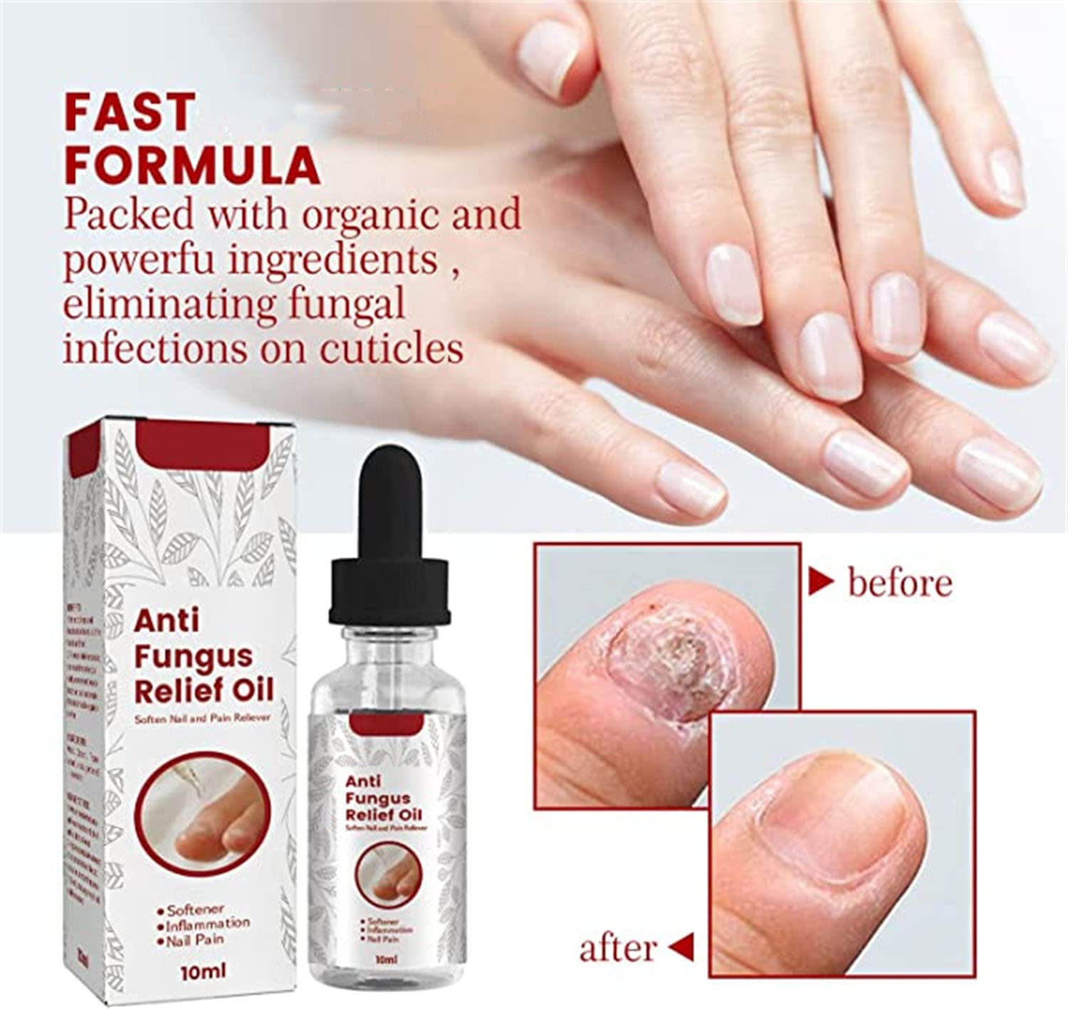 Nail Onychomycosis Rapid Relief Oil,Onychomycosis Nail Treatment Oil,Toenail Repair for Damaged