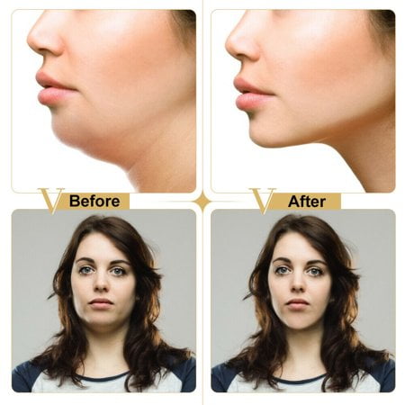 Find Cheap, Fashionable and Slimming v shaped face shaper