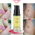 WANGJIAOID Pore Shrinking Removal Acne Scar Stretch Marks Cream Scar