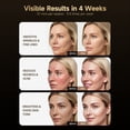 thumbnail image 5 of Morfone Red Light Therapy for Face, 4 Modes Led Face Mask Light Therapy with Remote, Portable Light Therapy Mask for Skin Care at Home, Travel (Black), 5 of 9