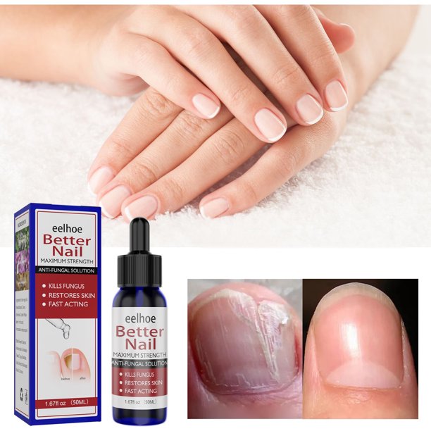 Solution From Nail Discoloration Nail Fingernail Toenail And Maximum