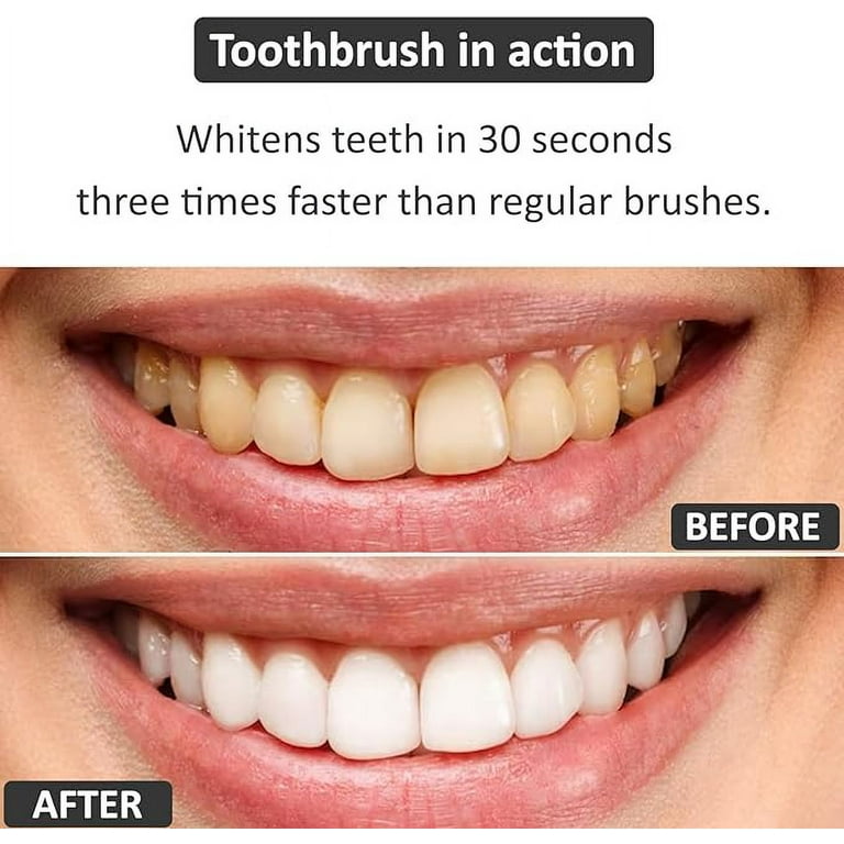 ToothTalk Teeth Whitening Kit,3Pcs Non-Sensitive Teeth