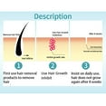 CENGZISHU Glee Facial Wax Strips Powerful Permanent Hair Removal Spray Stop Hair Growth
