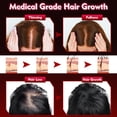 thumbnail image 4 of Wearable Red Light Cap for Scalp Wellness, Discreet Hands-Free Light Device with Adjustable Fit for At-Home Hair Care Routines, Portable & Rechargeable, 4 of 6