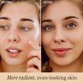 thumbnail image 2 of Beauty by Earth Vitamin C Serum for Face - USA Made with Natural and Organic Ingredients, Vit E, Ferulic and Hyaluronic Acid, 1oz, 2 of 7