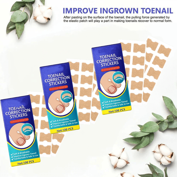 ingrown Toenail Treatment & Removal for Quick Relief, Ingrown Toenail Removal ，Professional Ingrown Toenail Corrector Patch, No-Glue Toenail Correction Stickers, 300 Pcs