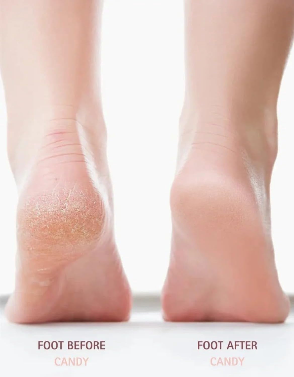 Nuve Silk 3 Pro Callus Remover,Callus Remover for Feet (Pink)