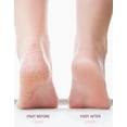 thumbnail image 3 of Nuve Silk 3 Pro Callus Remover,Callus Remover for Feet (Pink), 3 of 7
