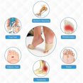 thumbnail image 5 of Gel Metatarsal Pads, Metatarsal Pads, Breathable Foot Pain Relief Foot Pads, 5 of 5