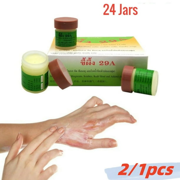 Ringworm Treatment Herbal & Natural Ointment Relieves Itching 29A