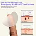 thumbnail image 4 of Pimple Patch Curology Emergency Spot Clusters, 14 unidades, 4 of 8