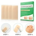 thumbnail image 6 of Aliver 4 Reusable Scar Silicone Scar Sheet, Silicone Tape for Scar Tape, 6 of 7