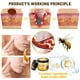 thumbnail image 3 of Crema Hidratante para la Piel YIVANNUO con Veneno de Abeja 2 x 60 g, 3 of 7