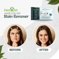 thumbnail image 2 of Herbishh Hair Color Stain Remover Wipes - Gentle Formula for Dye Cleanup - Easy Clean Travel Pack With 5 Skin-Friendly Wipes (Pack of 1), 2 of 7