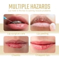 thumbnail image 4 of Máscara de labios de colágeno, almohadilla labial Colágeno 18 piezas de nutrición antigriolas de piel muerta extrila hidratacia para labio agrietado, 4 of 7