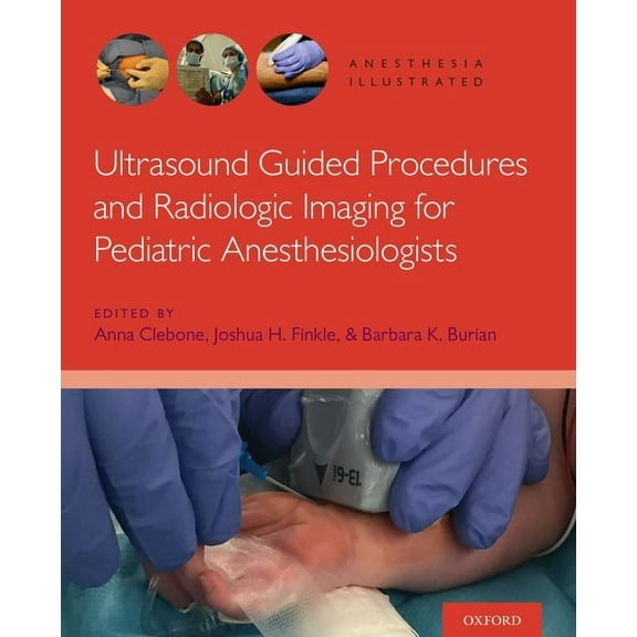Anesthesia Illustrated Ultrasound AI P, (Paperback)