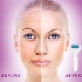 thumbnail image 3 of Rouleau Derma 6 en 1 pour Soins du Visage avec Micro Aiguilles, Microneedles en Acier Inoxydable pour Vergetures de Grossesse, Perte de Cheveux et Anti-Rides, 3 of 6