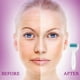 thumbnail image 3 of Rodillo Derma de microagujas 6 en 1 para cuidado facial con microagujas, microagujas de acero inoxidable para estrías de embarazo, pérdida de cabello y antiarrugas Ormromra Cepillos Faciales, Electrónicos o Sónicos, 3 of 8