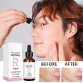 thumbnail image 3 of Retinol Face Serum for Brightening Tone, Fine Line Smoothing Firming Essence, Anti Aging Lifting Treatment for Wrinkles, Dropper Bottle for Daily Glow, 3 of 7