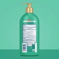 thumbnail image 5 of Gold Bond Medicated Extra Strength Body Lotion, Moisturizes, Relieves and Soothes, 14 oz. Gold Bond Lotion, 5 of 11