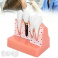 thumbnail image 1 of Modelo De Análisis De Implantes Dentales, Material De Resina Conveniente Demostración De Extracción Demostración Del Modelo De Diente Aprendizaje Del Estudiante Para, 1 of 7