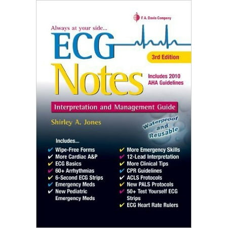 ECG Notes : Interpretation and Management Guide (Best Ecg Machine With Interpretation)
