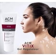 thumbnail image 1 of Vitix regulating gel para Vitiligo, 1 of 2
