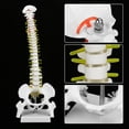 thumbnail image 3 of Modelo de columna vertebral, modelo de anatomía de columna vertebral extraíble, para estudios de anatomía de esqueleto de la escuela de medicina y el hospital de ense?anza Amonsee NO, 3 of 6