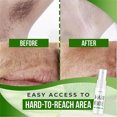 thumbnail image 3 of NARABB Vaporisateur Anti-Inhibition des Poils 40ml, 3 of 7