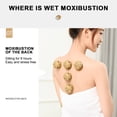 thumbnail image 7 of Portable Moxibustion Box Set, Moxibustion Stick and Treasure for Warm Fumigation Therapy Household TCM Acupoint Heating Relief Relaxation Adjustable with Carrying Bag, 7 of 7