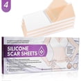 thumbnail image 4 of Silicone Gel Surgery Scar Tape | Reusable 4pcs | Skin Correctors | Burn Patch | Lightweight & Multifunctional | Promotes Growth | Skin Accessories, 4 of 4