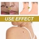 thumbnail image 5 of Skin Tag Recede Bee Venom Treatment Cream, Tag Remover, Bee Venom Cream, for All Skin Types, 5 of 5