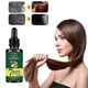thumbnail image 3 of piezas de 30 ml de aceite esencial de jengibre para el cuidado del cabello, 7 días de duración, mejora el entorno del cuero cabelludo, tratamiento contra la caída del cabello, aceite esencial para e, 3 of 5