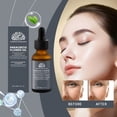 thumbnail image 2 of WIFKLSIIPG Huile de Fleur de Paracre Réduit Efficacement les Ridules du Visage et la Douceur de la Peau (30ml), 2 of 8
