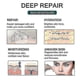 thumbnail image 4 of Elaimei Self adhesive Scar Stickers Scar Removal Patch Remove Trauma Burn Sheet New 8317095404777, 4 of 5
