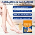 thumbnail image 2 of Fungal Nail Patches JOYJAR Extra Strength 21 Patches, 2 of 6