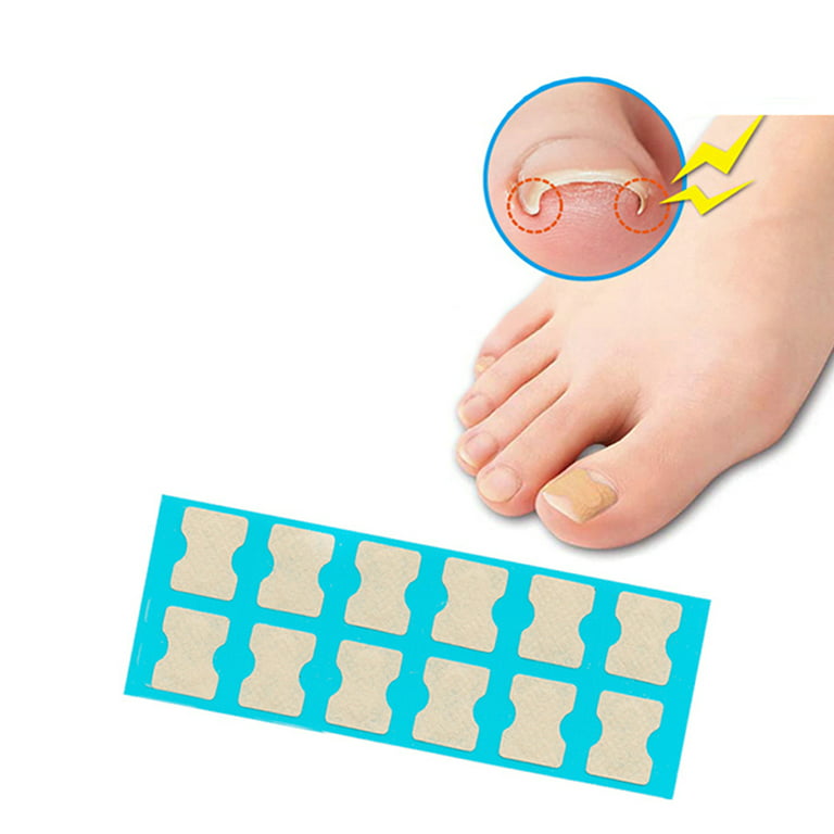 Silicone Nail Tools Stickers Toenail Correction Straightener