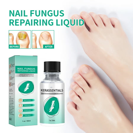 Repairing Oil for Nails | Safe Nail Strengthening Lotion Nail Growth Cuticle Oil for Women | Nail Repair Liquid for Discolored and Damaged Nails