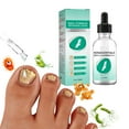 thumbnail image 1 of Aceite Para Hongos En Las Uñas De Los Pies, Líquido Fácil De Aplicar Para Eliminar Hongos En Las Uñas, Suave Para El Cuidado De Las Uñas, 1 of 8