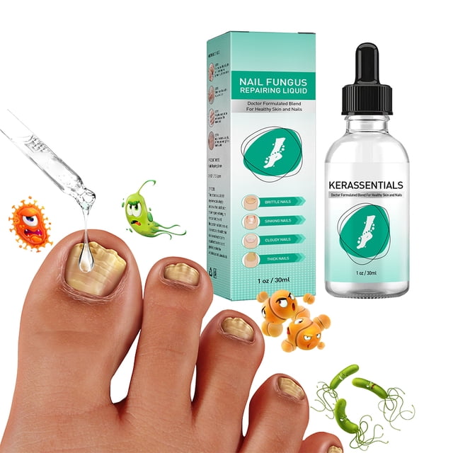 Aceite Para Hongos En Las Uñas De Los Pies, Líquido Fácil De Aplicar Para Eliminar Hongos En Las Uñas, Suave Para El Cuidado De Las Uñas