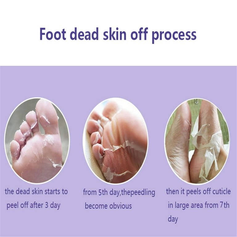 Skin Care Ginseng Extract Remove Foot Dead Skin Mask Foot Care Peeling  Exfoliating Skin Socks Whitening Beauty Feet Care Cream 