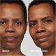 thumbnail image 3 of Sérum clínico Even Better de Foundation Clinique con factor de protección 25, 3 of 6