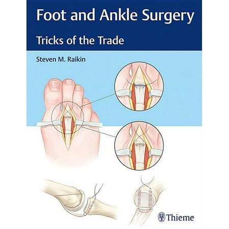 UPC: 9781626234918 | Foot and Ankle Surgery : Tricks of the Trade (Hardcover)