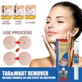 thumbnail image 1 of Removedor de verrugas Skin Tag Pen Professional Papillomas Moles Removal Pen (02) Ndcxsfigh Nuevos Originales, 1 of 8