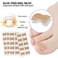 thumbnail image 5 of Parche de corrección de uñas, 50 piezas de pegatinas para el cuidado de los pies, pegatinas para corrección de uñas de los pies, pegatinas profesionales para corrección de uñas de pedicura para hombr, 5 of 5